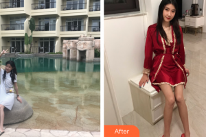 廣州醫(yī)學院第二附屬醫(yī)院整形美容中心黎志中整形價格表附白瓷娃娃案例展示