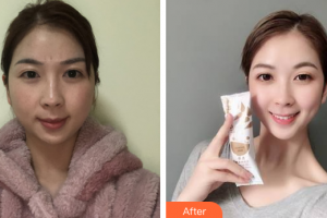 廣州軍美整形醫(yī)院何蘭清整形價格表附激光美膚祛斑案例展示