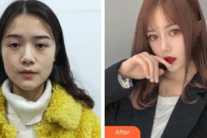 上海凱渥醫(yī)療美容門(mén)診部陳小萱整形價(jià)格表附美鼻部手術(shù)案例展示