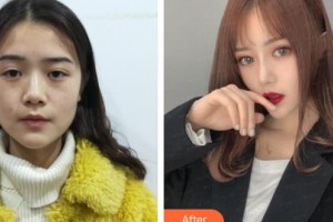 上海港華醫(yī)院浦東分院（悅?cè)葆t(yī)療美容診所）李靜琳整形價(jià)格表附美鼻部手術(shù)案例展示