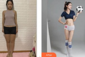 上海蔡仁祥醫(yī)療美容診所蔡仁祥整形價(jià)格表附腰腹環(huán)吸+大小腿吸脂案例展示