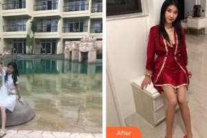 上海時(shí)光整形外科醫(yī)院陳文慧整形價(jià)格表附白瓷娃娃案例展示