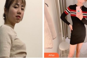 上海萬安醫(yī)療美容醫(yī)院馬晶波整形價格表附光子套餐案例展示