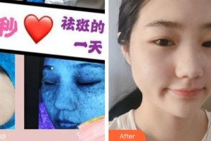 上海百達麗醫(yī)療美容醫(yī)院王耀萍整形價格表附超激光美膚祛斑案例展示