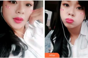 宜昌第二人民醫(yī)院醫(yī)學(xué)美容科朱遠(yuǎn)平整形價格表附　　昨天充滿勇氣地去嘗試了冷光美白牙齒，今天就來和大家分享一下～ 調(diào)節(jié)開始前醫(yī)生先找出了我牙齒原來的色號，并且會告知做完之后大概會白到哪個色號。我之