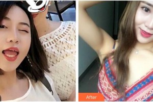 上海雅悅口腔門診部黃潔整形價格表附全隱形牙齒矯正案例展示