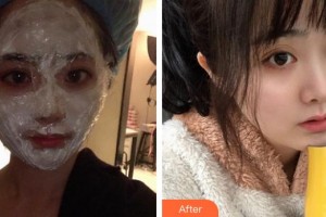 上海迪寇醫(yī)療美容門診部高中玉整形價格表附四代熱瑪吉案例展示