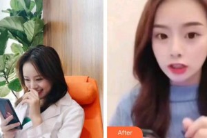 上海維樂口腔門診部翟建博整形價格表附超聲波潔牙案例展示