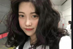 南京金臺(tái)口腔門診部陳馨玉整形價(jià)格表附牙貼面案例展示