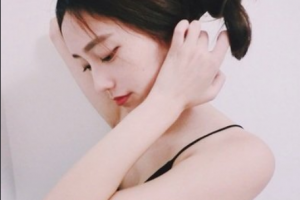 南京愛爾眼科醫(yī)院蔣麗整形價(jià)格表附切開雙眼皮案例展示