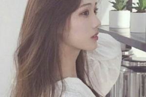 南京鼓樓醫(yī)院集團(tuán)儀征醫(yī)院醫(yī)療美容科葛華強(qiáng)整形價(jià)格表附埋線雙眼皮案例展示