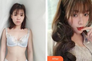 上海愛爾麗醫(yī)療美容門診部李鐵國整形價格表附濃縮豐胸真實案例展示