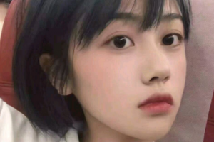 南京寧益眼科中心門診部鮑連云整形價(jià)格表附切開雙眼皮案例展示