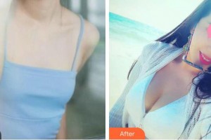 成都漢密爾頓美容醫(yī)院陳佩珍教授整形價格表附自體脂肪豐胸案例展示