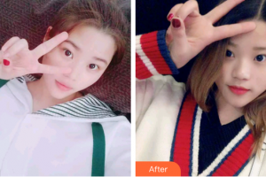 廣州遠(yuǎn)東美容醫(yī)院黃履攸整形價格表附冷光美白案例展示