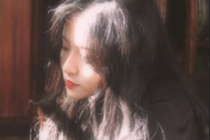 南京雅康口腔門診部王志軍整形價(jià)格表附金屬托槽矯正案例展示