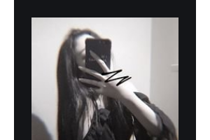 南京博韻口腔門診部徐云云整形價(jià)格表附根管調(diào)節(jié)案例展示