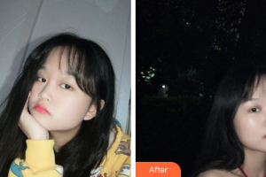 廣州博研醫(yī)療美容門診部劉紅梅整形價(jià)格表附光子嫩膚案例展示