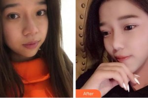 成都艾尚醫(yī)學美容門診部嚴新整形價格表附祛斑案例展示