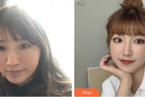 成都艾尚醫(yī)學(xué)美容門(mén)診部江海燕整形價(jià)格表附超激光美膚美白嫩膚案例展示