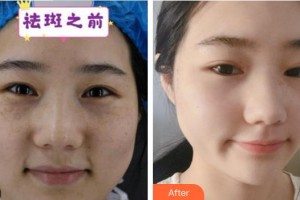 成都蜀尚蓉雅美容整形醫(yī)院羅莉萍整形價(jià)格表附激光美膚祛斑案例展示