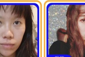 成都金榮醫(yī)學(xué)美容診所葛冬梅整形價(jià)格表附鼻部手術(shù)脂肪填充案例展示