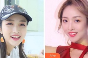 成都醫(yī)美整形美容醫(yī)院劉玉林整形價(jià)格表附隱形托槽矯正案例展示