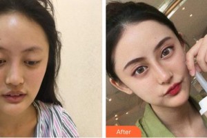 成都悅好醫(yī)學美容醫(yī)院韓炯逸整形價格表附鼻部手術(shù)案例展示