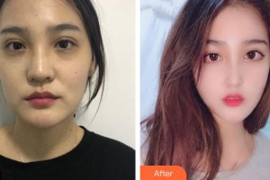 成都臺美仁仁醫(yī)學美容診所柯樹英整形價格表附鼻部手術(shù)案例案例展示