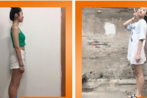 成都百齡駐顏醫(yī)學美容門診部肖宛平整形價格表附美體塑形案例展示