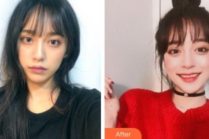 成都米蘭柏羽醫(yī)學美容醫(yī)院唐桂茹整形價格表附光子嫩膚案例展示