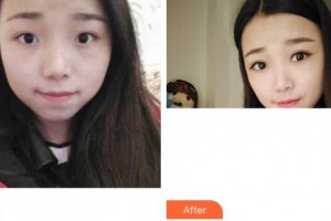 成都美容整形醫(yī)院沈燕華整形價(jià)格表附眼部綜合案例展示