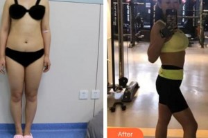 成都華顏醫(yī)療美容門診部姜楠整形價(jià)格表附美體塑形案例展示