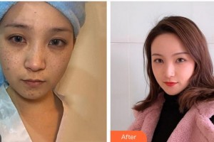 成都艾尚醫(yī)學美容門診部龔麟整形價格表附祛斑案例展示