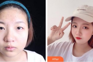 成都醫(yī)美整形美容醫(yī)院許文萍整形價格表附眼部綜合案例展示