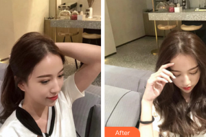 廣州華美醫(yī)療美容醫(yī)院馬奔芳整形價(jià)格表附皮膚管理案例展示