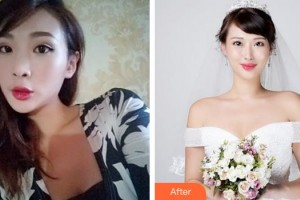 成都素美醫(yī)療美容診所李競整形價格表附鼻部綜合案例展示