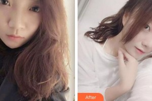 成都蜀尚蓉雅美容整形醫(yī)院馬歡整形價格表附激光美膚激光案例展示