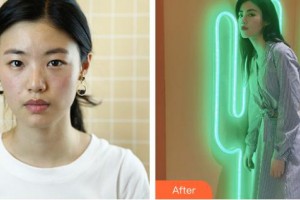 成都度曼美醫(yī)療美容診所趙霞整形價格表附切開雙眼皮案例展示