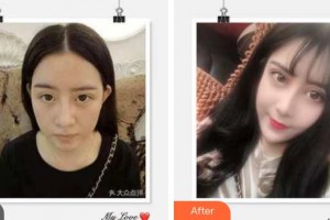 成都美卿醫(yī)療美容醫(yī)院達文整形價格表附瘦臉案例展示