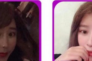 成都修膚堂皮膚病診所唐紅霞整形價格表附果酸換膚案例展示