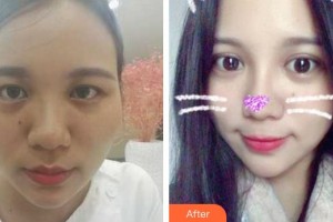 成都美呀皮膚醫(yī)學(xué)美容診所楊保華整形價格表附超激光美膚祛斑案例展示