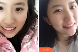 成都拉斐爾口腔門診部方園整形價格表附美白牙齒案例展示