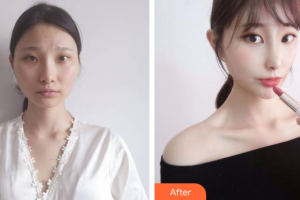 廣州軍區(qū)武漢總醫(yī)院醫(yī)學(xué)整形美容中心胡山整形價格表附面部吸脂案例展示