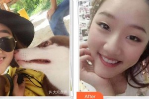 成都茁悅口腔診所曾紅整形價(jià)格表附牙齒矯正案例展示