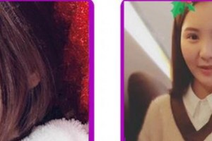 成都康橋眼科醫(yī)院蔡小玲整形價(jià)格表附牙齒隱形矯正案例展示