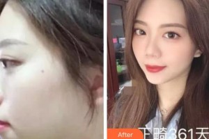 成都君臣口腔門診部董彰實(shí)整形價(jià)格表附金屬托槽矯正案例展示