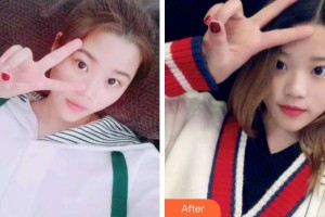 成都純福口腔診所馬華鈺整形價(jià)格表附冷光美白案例展示