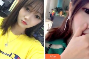 成都純?？谇辉\所劉純虎整形價(jià)格表附超聲波潔牙案例展示