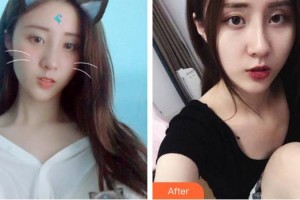 成都中醫(yī)大銀海眼科醫(yī)院周華祥整形價格表附眼部整形案例展示